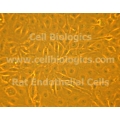 ZDF Rat Diabetic Prostate Microvascular Endothelial Cells